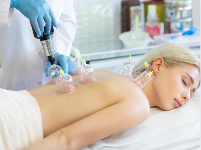 Traditional cupping therapy glass cup suction treatment for back pain relief and muscle relaxation,